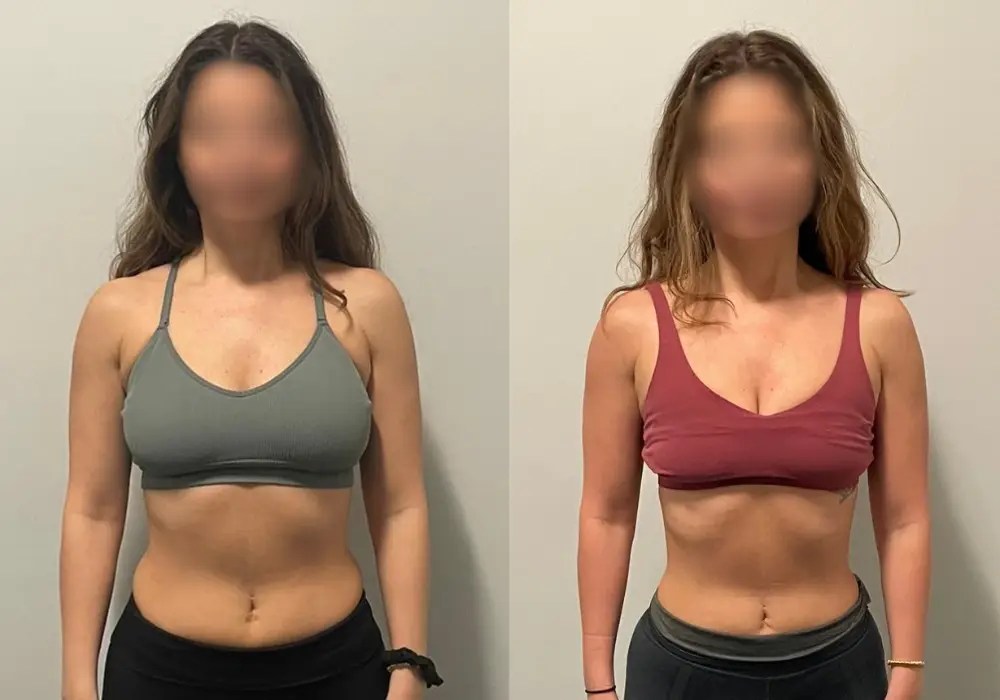 Authentische Transformation eines Athletic M Klienten